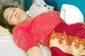 Thiếu phụ b&aacute;n v&eacute; số bị ch&eacute;m đứt g&acirc;n tay